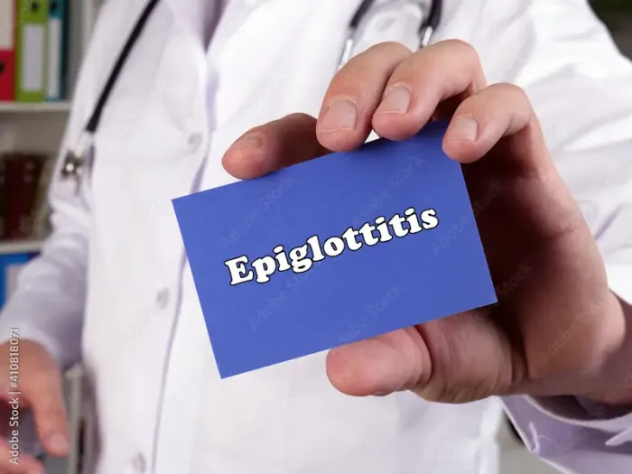 Epiglottitis Overview Symptoms, Causes, and Treatment